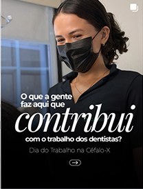 Post do Instagram Céfalo-X